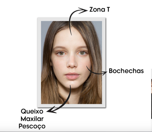 Acne - Como Controlar