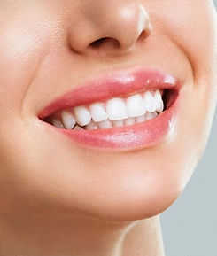 perfect-healthy-teeth-smile-young-woman-teeth-whitening-stomatology-concept_168410-877_edi