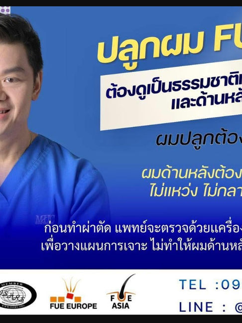 Hair Transplant in Bangkok: Why FUE is the Best Solution for Natural Results