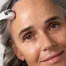 microneedling photo.webp