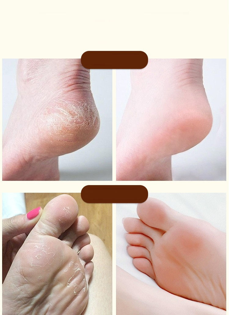 Thumbnail: Nourishing Foot Repair Cream