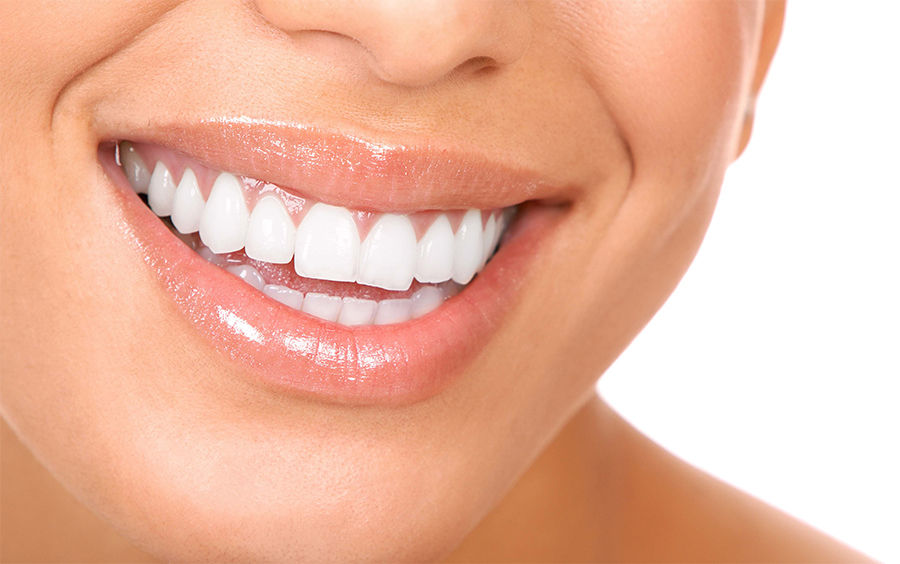 esmalte-dental