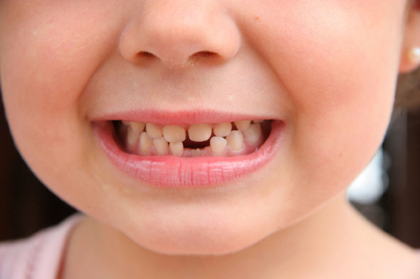 caida-dientes-leche