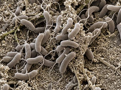 Scanning electron micrograph of rod-shaped bacteria clustered on a rough surface, forming a dense gray biofilm.
