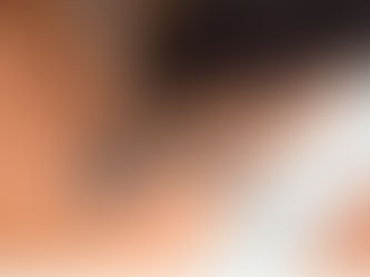 إزالة الوشم بالليزر: طريقة العمل وكل ما تحتاجين إلى معرفته