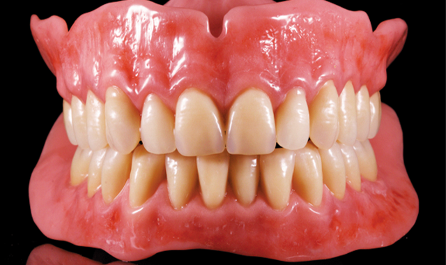 Fixed & Removable Dentures