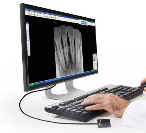 Digital X-ray