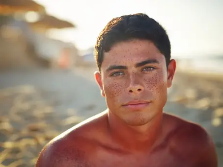 Sun-Damaged Skin in Louisiana: How a Facial Repairs an Outdoor Lifestyle