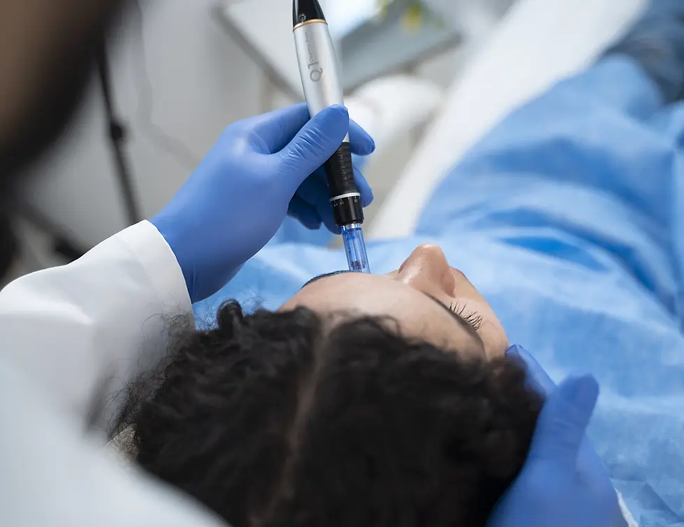 How Often Should You Get Microneedling for Best Results?