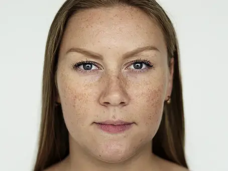 Fading Sun Spots & Age Spots: Advanced Plasma Pen Therapy in Shreveport