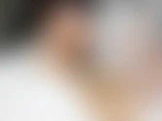 Underarms Laser Hair Removal in Shreveport and Bossier City