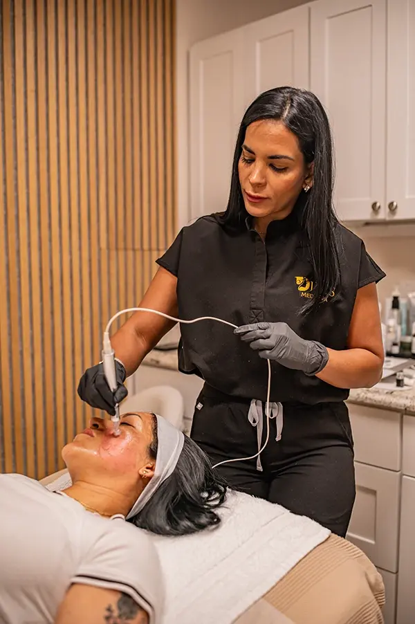 Does Microneedling Actually Fix Acne Scars