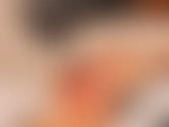 What is the Most Effective Microneedling Treatment?