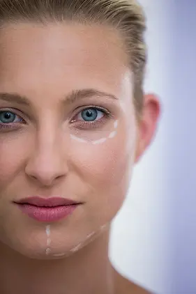 Botox.webp