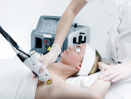 What Type of Laser is the Candela GentleMax Pro
