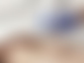 Professional Treatment for Facial and Leg Spider Veins in Shreveport, LA