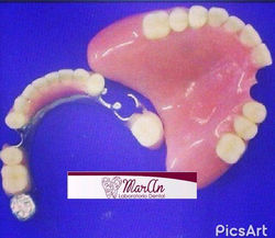 protesis acrilicas y metal -acrilica