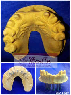 Troquelados MarAn Lab dental