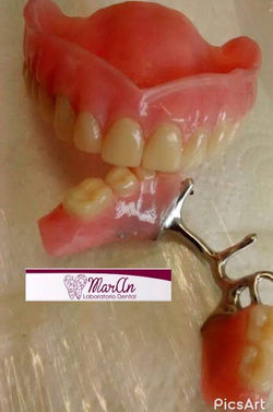 removible y protesis total