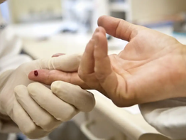 Casos de sífilis e de HIV/aids aumentam entre homens jovens