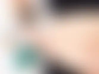 Before and after comparison showing reduction of abdominal fat pinch