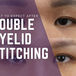 What to Expect After Double Eyelid Stitching: A Clinical Recovery Guide