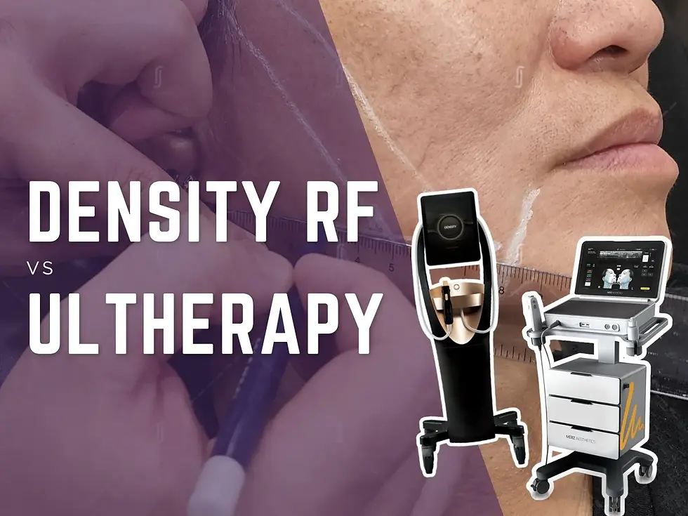 Density RF vs Ultherapy skin tightening consultation at RJ Clinic Kuala Lumpur