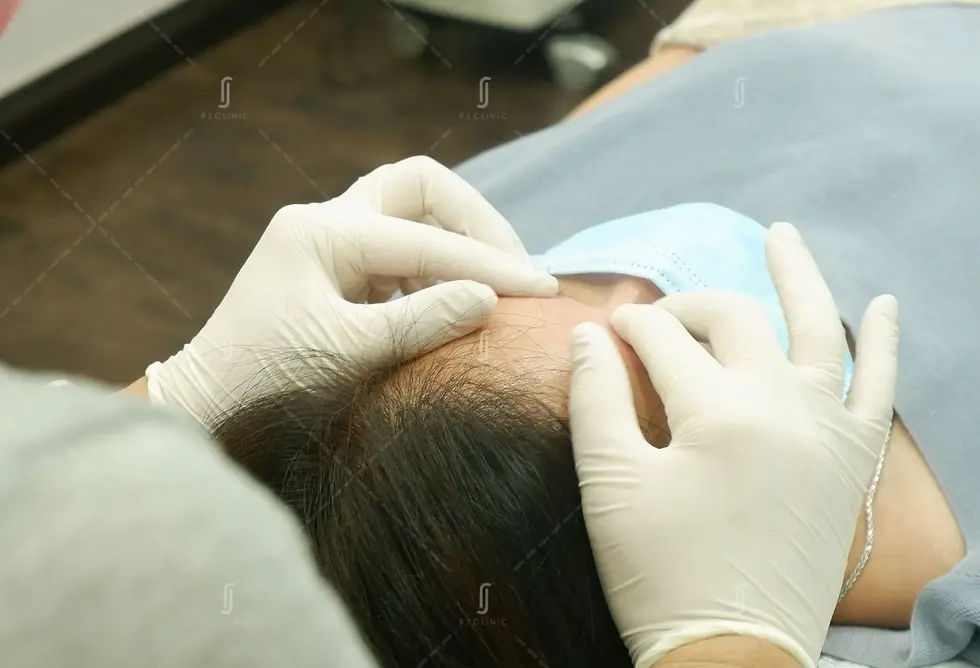 PRP hair treatment session at RJ Clinic Malaysia for restoring hair growth after stress