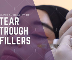 RJ Clinic Tear Trough Filler Safety Guide and Risks Assessment in Malaysia