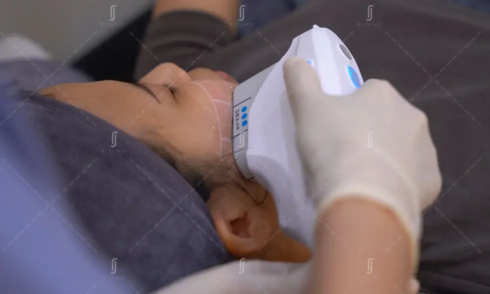 RJ Clinic Ultherapy Prime jawline lifting treatment for sagging jowls and facial contouring