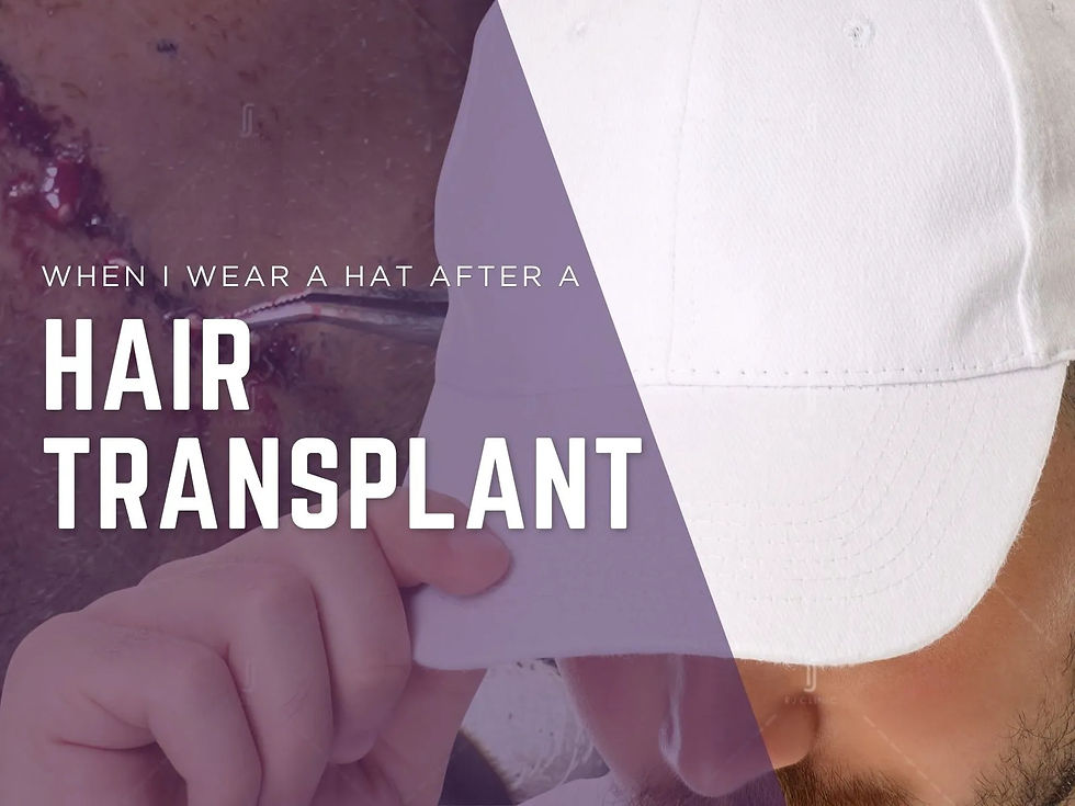 When Can I Wear a Hat After a Hair Transplant? A Clinical Recovery Timeline
