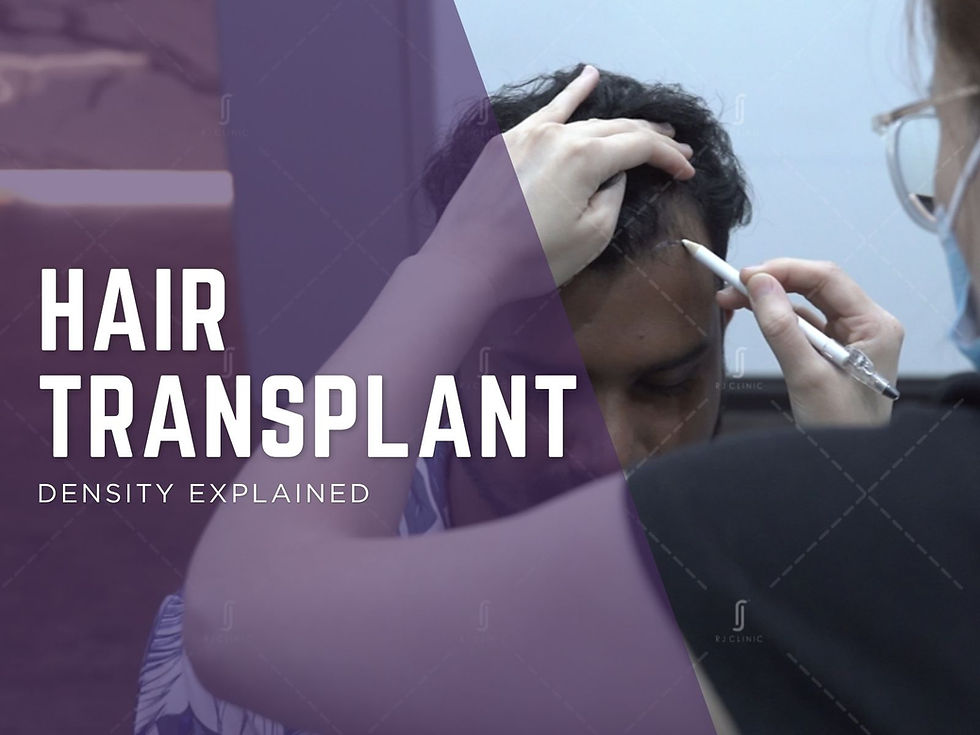 RJ Clinic explaining hair transplant density and natural FUE hair restoration planning in Malaysia.
