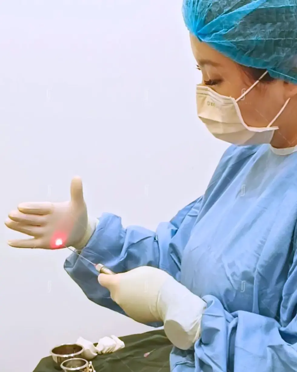 RJ Clinic AccuSculpt laser lipolysis procedure in Kuala Lumpur showing precision fat melting technology