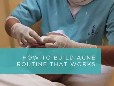 RJ Wellness guide on how to build an acne routine that works for clearer and healthier-looking skin