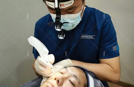 plexr-mole-removal-rj-clinic-eco-santuar