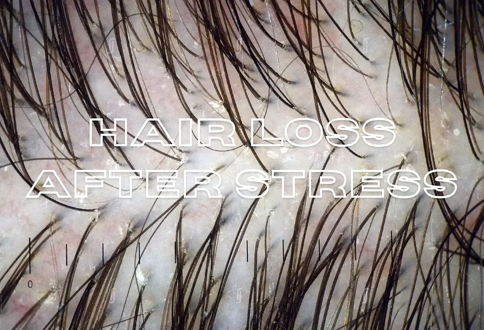 Close-up of scalp showing telogen effluvium hair shedding at RJ Clinic Kuala Lumpur