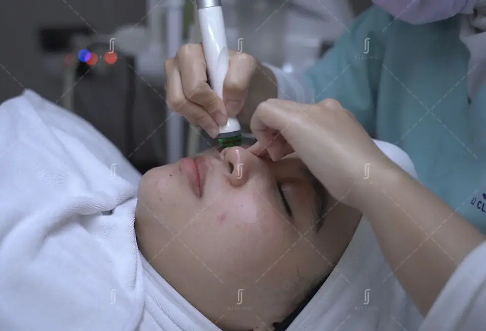 RJ Clinic SilkPeel medical facial for deep cleansing and skin hydration in Malaysia