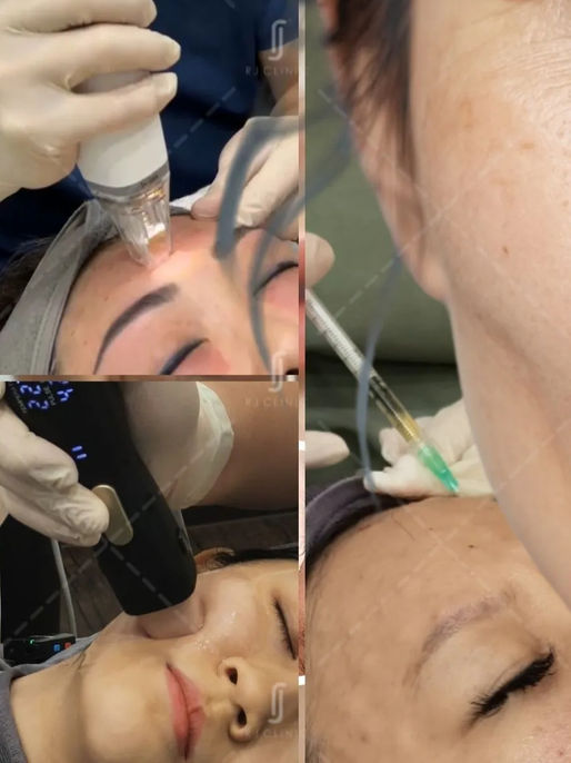 RJ Clinic anti-aging and facial rejuvenation treatment in Kuala Lumpur