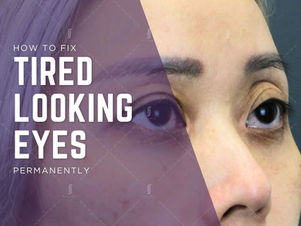 How to Fix Tired Looking Eyes Permanently: A Clinical Guide to Eye Rejuvenation