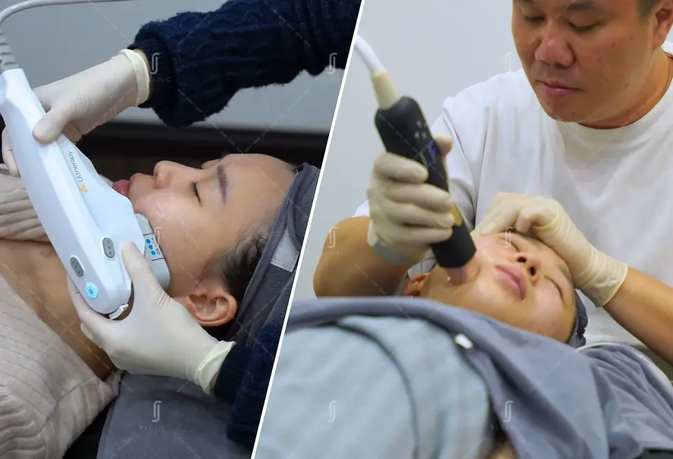 RJ Clinic skin tightening treatment Ultherapy Prime and Density RF