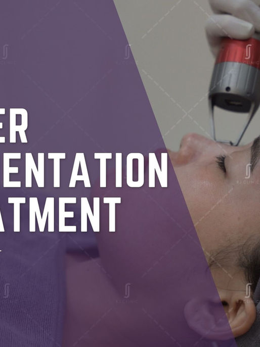 Laser Pigmentation Treatment Cost in KL: Clinical Guide