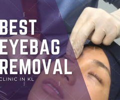 Best Eye Bag Removal Clinic in KL: A Clinical Framework for Choosing the Right Treatment (2026)