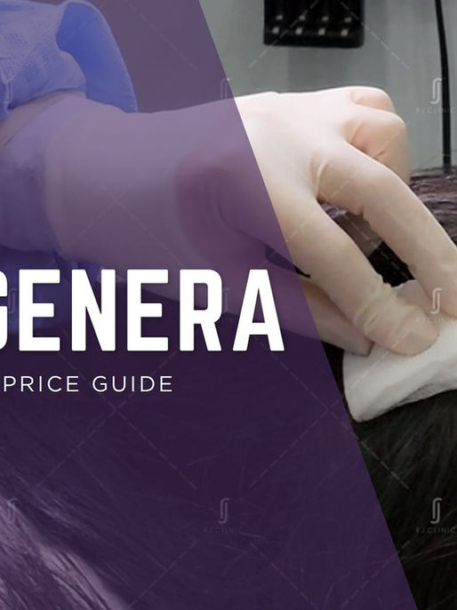 RJ Clinic Regenera Malaysia Price Guide for hair restoration treatment