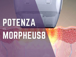 Potenza vs Morpheus8: Best RF Microneedling in Kuala Lumpur