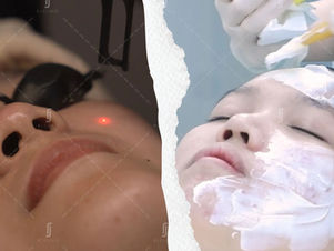 Laser vs. Chemical Peel in Malaysia: Which Skin Resurfacing Treatment is Right for You?