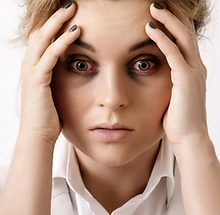deusaderm-treatment-kl-header_edited.png