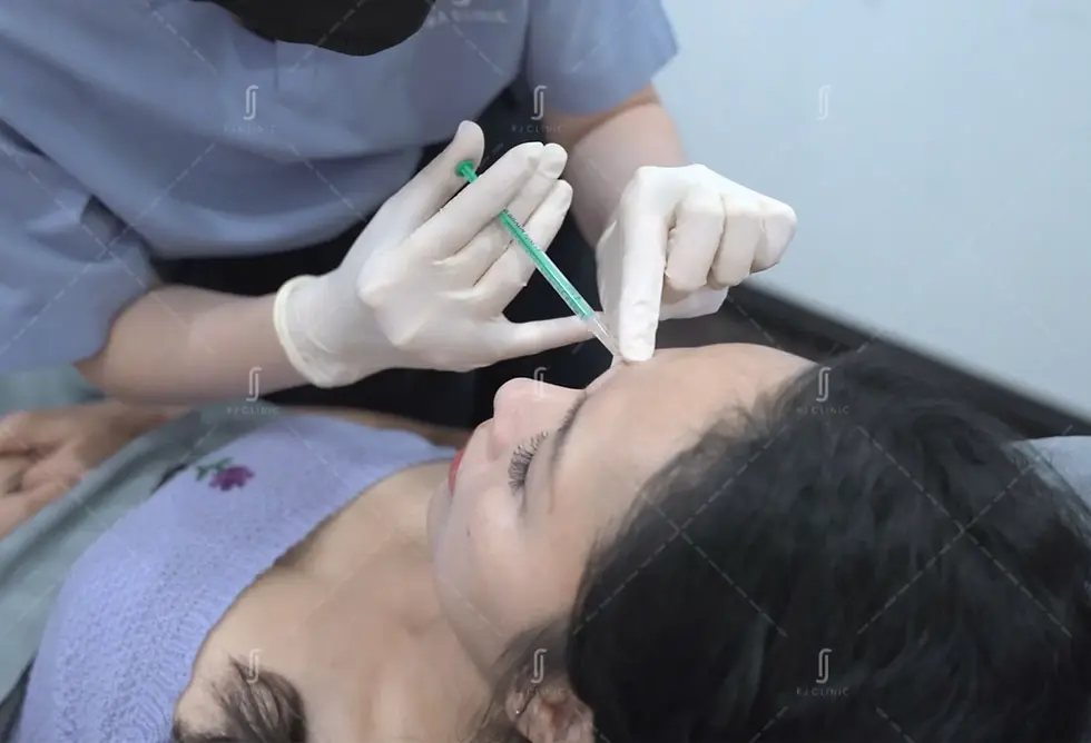 Botox jaw slimming treatment at RJ Clinic Kuala Lumpur targeting masseter muscles for V shape face