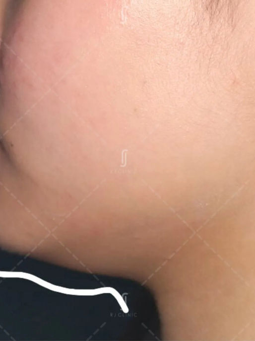 Why Your Fat Reduction Treatment Isn’t Working: A Clinical Perspective from Kuala Lumpur