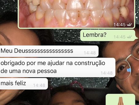 Transformação de um Sorriso!