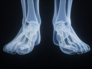 Dolore ai metatarsi del piede: cause e trattamenti consigliati - https://unsplash.com/it/foto/radiografia-di-piedi-umani-su-uno-sfondo-nero-IhGonjnG148